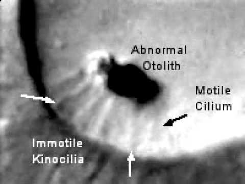 A beating motile cilium