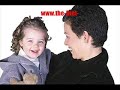 Vitamin B12 Deficiency - Video Tutorial #1 Vitamin B12 Deficiency - Video Tutorial #1