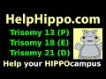 Trisomy 21 18 13 mnemonic tutorial: Down's Syndrome, Edwards, Patau