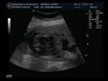 Pedro Henrique ta vindo a�!!! Meu 1� sobrinho...