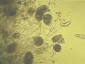a lot of microscopic organism going to restaurants....