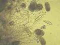 a lot of microscopic organism going to restaurants....