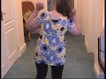 Amy (Cockayne Syndrome) Walks Tall