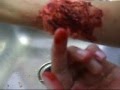 zombie flesh wounds