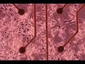 Neurons in action on an MEA