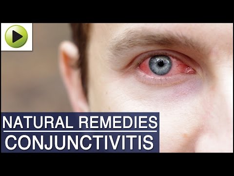how to help pink eye