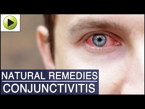 how to treat viral pink eye