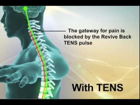 how to relieve epigastric pain