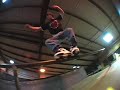 Vertigo
