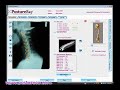 PostureRay - Lateral Cervical X-Ray Digitization Demo