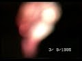 Los Suspensivos - About a girl (03-09-1995)