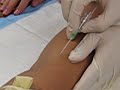 IV-training
