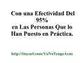 Como Curar el Acne - Como Tratar el Acne - remedios caseros para acne - barros