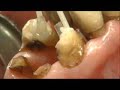 Video_C&Post_eng2.wmv