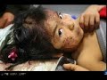 peru   terremoto