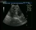 Ecografia Thiago L�pez Moro (24 semanas)