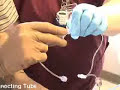 Arterial Line Placement