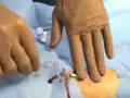 Arterial Line Placement