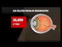 Blindness drug refused by NHS