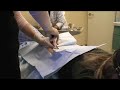 Bone Marrow Biopsy 2 Bone Marrow Biopsy 2