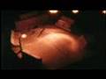 Close Encounters (of the Repulsive Kind!)