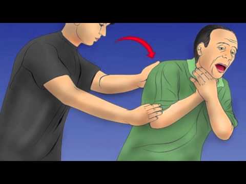 how to perform the heimlich maneuver