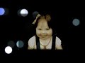 Down syndrome:&nbsp;Down Syndrome Kate