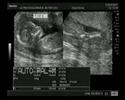 Milena nen�m (Fernanda e Leandro)