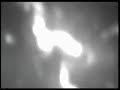 Trisomie 21 - la fête triste