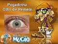 Mucao.com.br - Pegadinha - Olho de Remela Mucao.com.br - Pegadinha - Olho de Remela