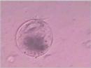 Ciliated protozoo 2