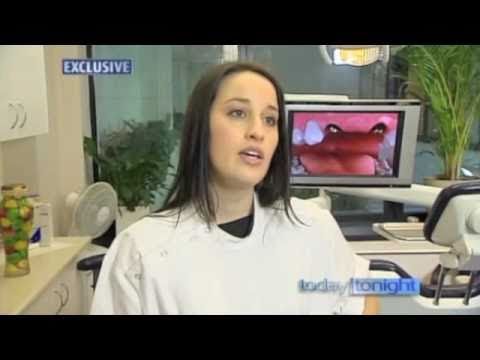 how to get snap on smile