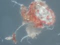 morgellons sparkly silicon nano lights