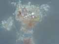morgellons sparkly silicon nano lights