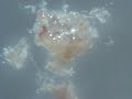 morgellons sparkly silicon nano lights