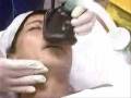 Breast Reduction Surgery Start
