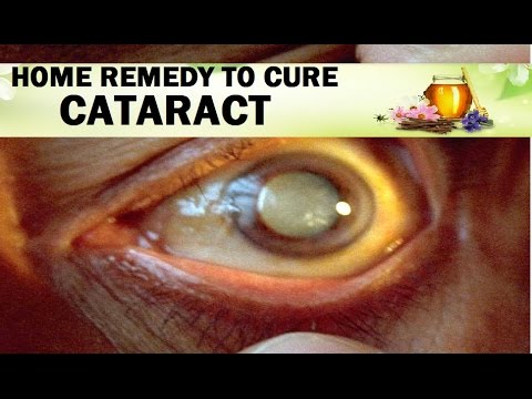 how to cure katarata