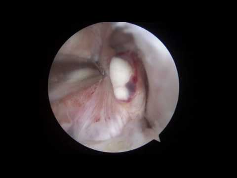 0 What Happened To My Knee