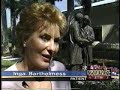 Endoscopic Facelift in Naples Florida Endoscopic Facelift in Naples Florida