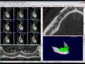 videos de Bioparts - Tutorial 4 DentalSlice: Janela Axial