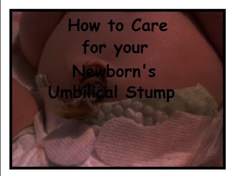 how to know if umbilical cord is infected