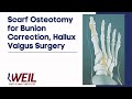 Scarf Osteotomy for Bunion Correction, Hallux Valgus Surgery | Weil Foot & Ankle Institute