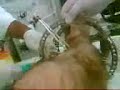 removing metal from leg removing metal from leg