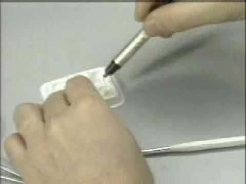 ANTERIOR VENEER CROWN P1