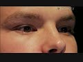 Thumbnail #1