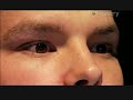 Thumbnail #3