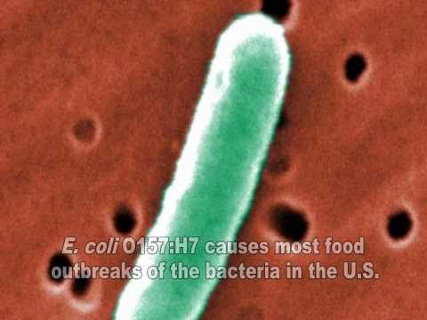 e coli - E. coli are a large and diverse group of bacteria. Although most strains of E. coli are harmless, others can make people sick. Some kinds of E. coli can caus...