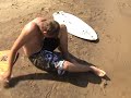Skimboard broken ankle Skimboard broken ankle