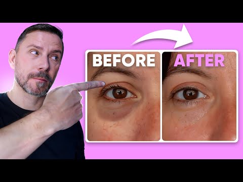 Bags - CELEBRITY MAKEUP MISTAKES! CLICK TO WATCH! http://www.youtube.com/watch?v=2JPo0kdB30c ♥ MY VLOG CHANNEL! ♥ http://www.youtube.com/user/gossmakeupchat ♥ FACEBOOK ♥ http://www.facebook.co...