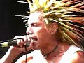 The Casualties